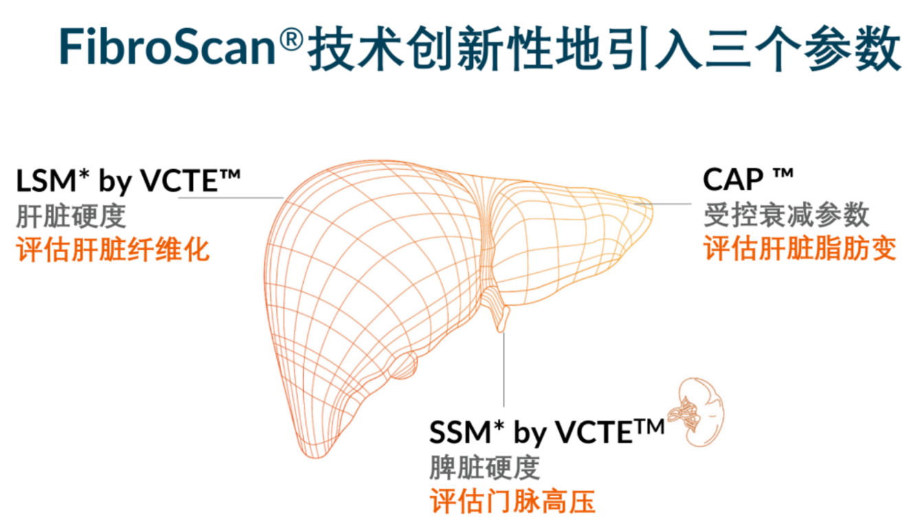 喜訊！FDA擴大了FibroScan?在肝臟綜合管理中的應(yīng)用范圍